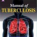 Manual of Tuberculosis