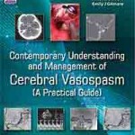 Contemporary Understanding and Management of Cerebral Vasospasm (A Practical Guide)