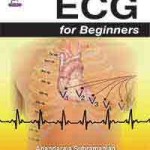 ECG for Beginners