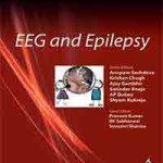EEG and Epilepsy