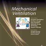 Mechanical Ventilation