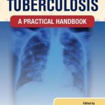 Clinical Tuberculosis  :  A Practical Handbook