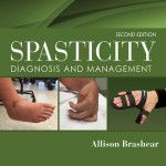 Spasticity  : Diagnosis and Management