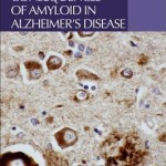 Intracellular Consequences of Amyloid in Alzheimer’s Disease