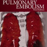Pulmonary Embolism