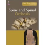 Spine and Spinal Orthosis
