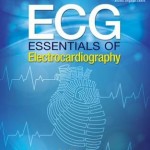 ECG : Essentials of Electrocardiography