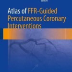 Atlas of FFR-Guided Percutaneous Coronary Interventions 2016