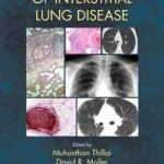 Clinical Handbook of Interstitial Lung Disease