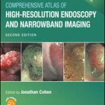 Comprehensive Atlas of High-Resolution Endoscopy and Narrowband Imaging