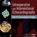 Intraoperative and Interventional Echocardiography