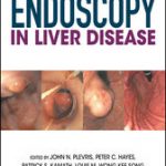 Endoscopy in Liver Disease