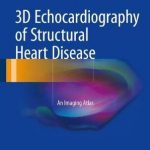 3D Echocardiography of Structural Heart Disease : An Imaging Atlas