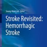 Stroke Revisited: Hemorrhagic Stroke