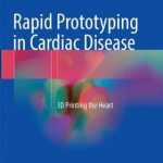 Rapid Prototyping in Cardiac Disease : 3D Printing the Heart