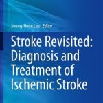 Stroke Revisited: Diagnosis and Treatment of Ischemic Stroke