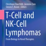 T-Cell and NK-Cell Lymphomas