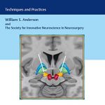 Deep Brain Stimulation : Techniques and Practices