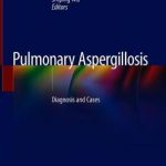 Pulmonary Aspergillosis : Diagnosis and Cases
