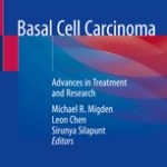 Basal Cell Carcinoma