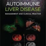 Autoimmune Liver Disease : Management and Clinical Practice