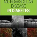 Microvascular Disease in Diabetes