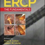 Ercp : The Fundamentals