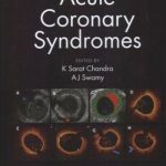 Acute Coronary Syndromes
