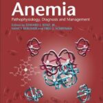 Anemia Paperback with Online Resource : Pathophysiology, Diagnosis, and Management