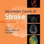 Uncommon Causes of Stroke