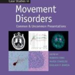 Case Studies in Movement Disorders : Common and Uncommon Presentations