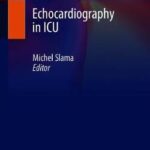 Echocardiography in ICU