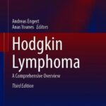 Hodgkin Lymphoma : A Comprehensive Overview