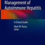 Diagnosis and Management of Autoimmune Hepatitis : A Clinical Guide