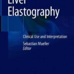 Liver Elastography : Clinical Use and Interpretation