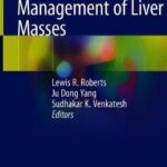 Evaluation and Management of Liver Masses
