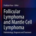 Follicular Lymphoma and Mantle Cell Lymphoma : Pathobiology, Diagnosis and Treatment
