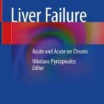 Liver Failure : Acute and Acute on Chronic