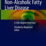 Non-Alcoholic Fatty Liver Disease : A 360-degree Overview