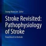 Stroke Revisited: Pathophysiology of Stroke : From Bench to Bedside