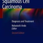 Esophageal Squamous Cell Carcinoma : Diagnosis and Treatment