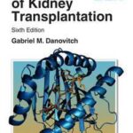 Handbook of Kidney Transplantation
