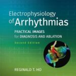Electrophysiology of Arrhythmias : Practical Images for Diagnosis and Ablation
