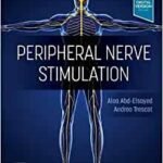 Peripheral Nerve Stimulation: A Comprehensive Guide