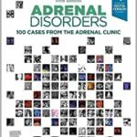 Adrenal Disorders: 100 Cases from the Adrenal Clinic