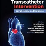 Aortic Valve Transcatheter Intervention: Complications and Solutions 1st Edition