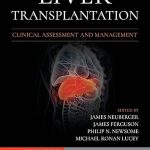 Liver Transplantation: Clinical Assessment and Management 2nd Edition