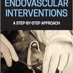 Endovascular Interventions: A Step-by-Step Approach