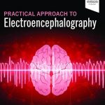Practical Approach to Electroencephalography 2nd Edition